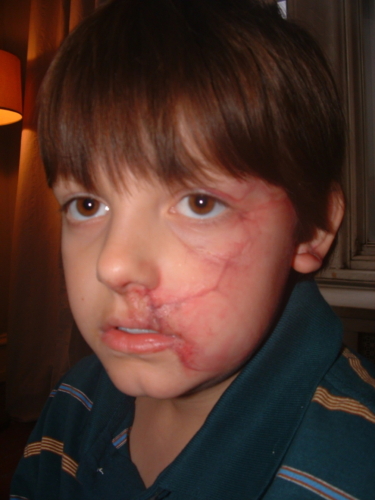 "Joey" Face Scar Makeup