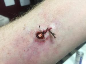infected gunshot wound sfx makeup