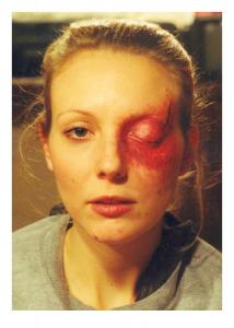 linda eye swelling trauma sfx makeup